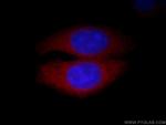 Calpain 2 Antibody in Immunocytochemistry (ICC/IF)