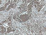 Calpain 2 Antibody in Immunohistochemistry (Paraffin) (IHC (P))