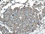 Calpain 2 Antibody in Immunohistochemistry (Paraffin) (IHC (P))