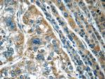 Calpain 2 Antibody in Immunohistochemistry (Paraffin) (IHC (P))