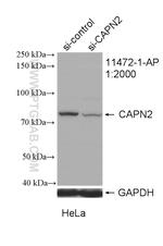 Calpain 2 Antibody in Western Blot (WB)