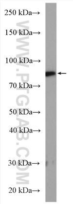 Calpain 2 Antibody in Western Blot (WB)