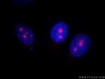 UTP14A Antibody in Immunocytochemistry (ICC/IF)