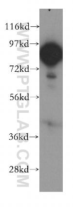 UTP14A Antibody in Western Blot (WB)