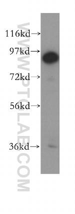 UTP14A Antibody in Western Blot (WB)