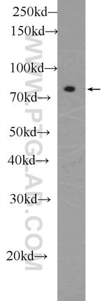 UTP14A Antibody in Western Blot (WB)