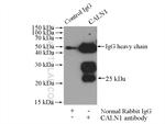 CALN1 Antibody in Immunoprecipitation (IP)