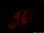 TIMM9 Antibody in Immunocytochemistry (ICC/IF)