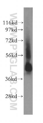 STAC Antibody in Western Blot (WB)