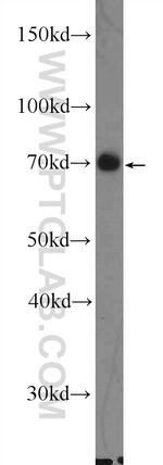 EIF3L Antibody in Western Blot (WB)