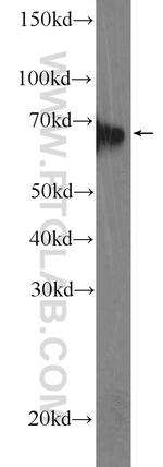 EIF3L Antibody in Western Blot (WB)