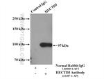 HECTD3 Antibody in Immunoprecipitation (IP)