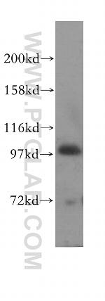 HECTD3 Antibody in Western Blot (WB)