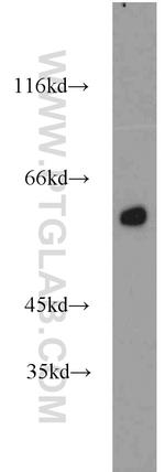 PHACS Antibody in Western Blot (WB)