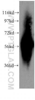 PHACS Antibody in Western Blot (WB)