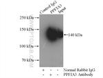 PPFIA3 Antibody in Immunoprecipitation (IP)