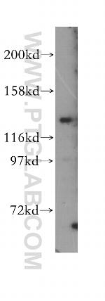 PPFIA3 Antibody in Western Blot (WB)