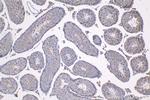 LMAN2 Antibody in Immunohistochemistry (Paraffin) (IHC (P))