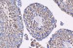 LMAN2 Antibody in Immunohistochemistry (Paraffin) (IHC (P))