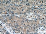 FBXW2 Antibody in Immunohistochemistry (Paraffin) (IHC (P))