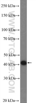 FBXW2 Antibody in Western Blot (WB)