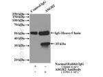 ASGR2 Antibody in Immunoprecipitation (IP)