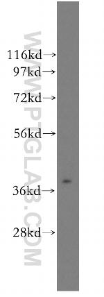 ASGR2 Antibody in Western Blot (WB)