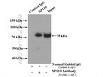 SP110 Antibody in Immunoprecipitation (IP)