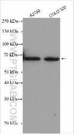 SP110 Antibody in Western Blot (WB)