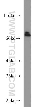 SP110 Antibody in Western Blot (WB)