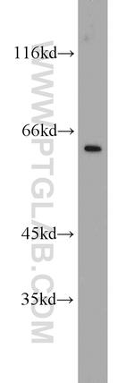 SP110 Antibody in Western Blot (WB)
