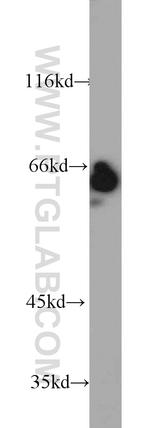 SP110 Antibody in Western Blot (WB)