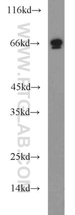 SP110 Antibody in Western Blot (WB)