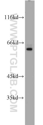 SP110 Antibody in Western Blot (WB)