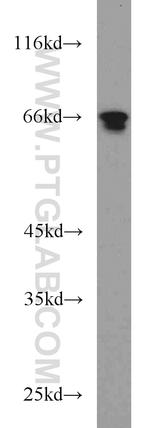 SP110 Antibody in Western Blot (WB)