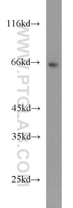 SP110 Antibody in Western Blot (WB)