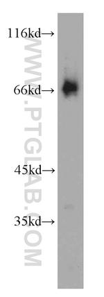 SP110 Antibody in Western Blot (WB)