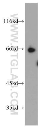 SP110 Antibody in Western Blot (WB)