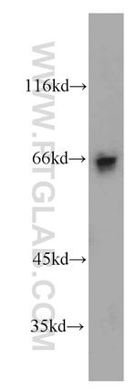 SP110 Antibody in Western Blot (WB)