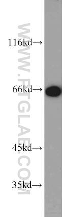 SP110 Antibody in Western Blot (WB)
