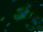 FRS2 Antibody in Immunocytochemistry (ICC/IF)