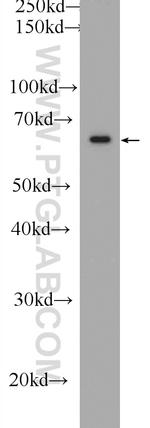 FRS2 Antibody in Western Blot (WB)
