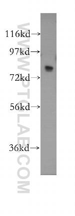 MED17 Antibody in Western Blot (WB)