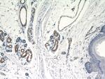 CNN3 Antibody in Immunohistochemistry (Paraffin) (IHC (P))
