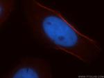 CNN3 Antibody in Immunocytochemistry (ICC/IF)