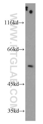 TRIM44 Antibody in Western Blot (WB)