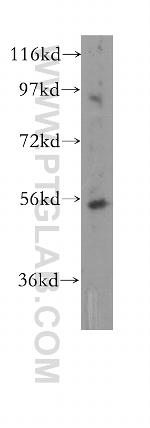TRIM44 Antibody in Western Blot (WB)
