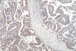 PUS1 Antibody in Immunohistochemistry (Paraffin) (IHC (P))