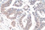 PUS1 Antibody in Immunohistochemistry (Paraffin) (IHC (P))