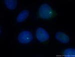 CENPJ Antibody in Immunocytochemistry (ICC/IF)
